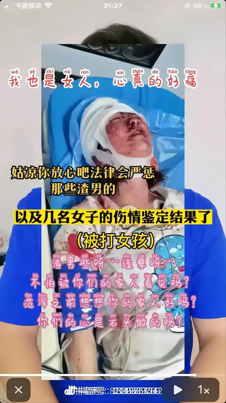 看着这女孩真心疼,好好吃个饭被打成这样,男人的手