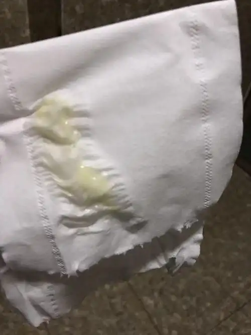 慎入白带有两三个月都是这样了有仙女知道是为啥吗