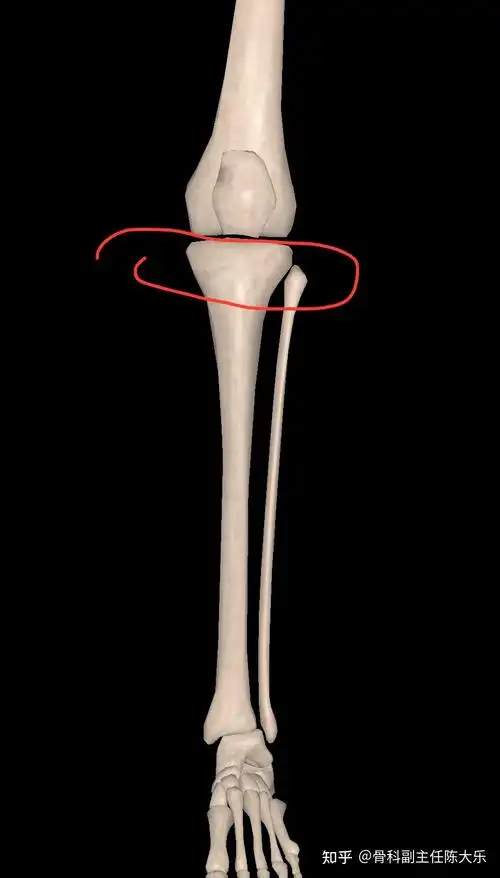 什么是胫腓骨平台? - 知乎