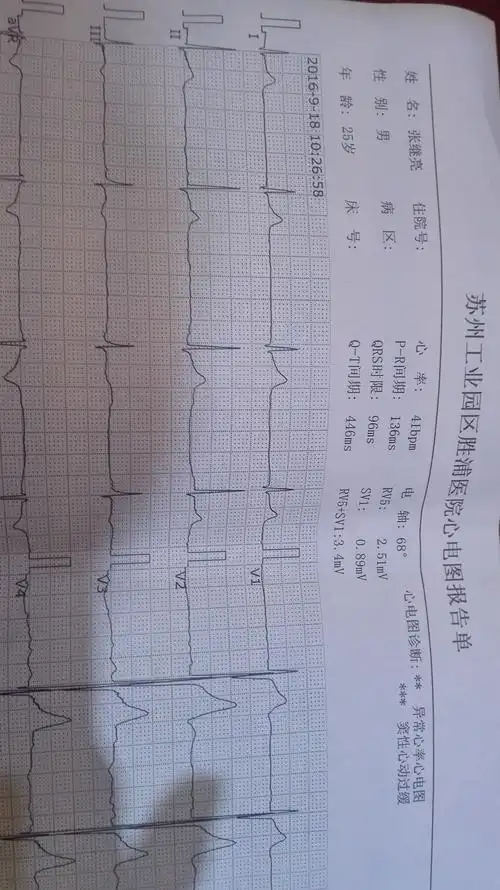刚做的心电图,早晨上班时突然晕倒.有没有懂得人,这样情况怎么办?