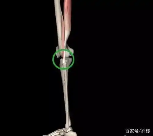 可以造成膝关节外侧下方,其在腓骨小头附着点的疼痛,也是跑步膝原因之