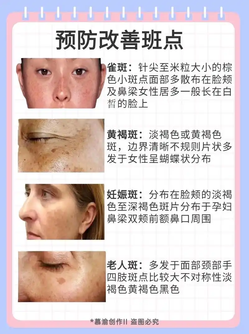 斑点女生必看7515你清楚自己长斑点原因吗71.友友你好!