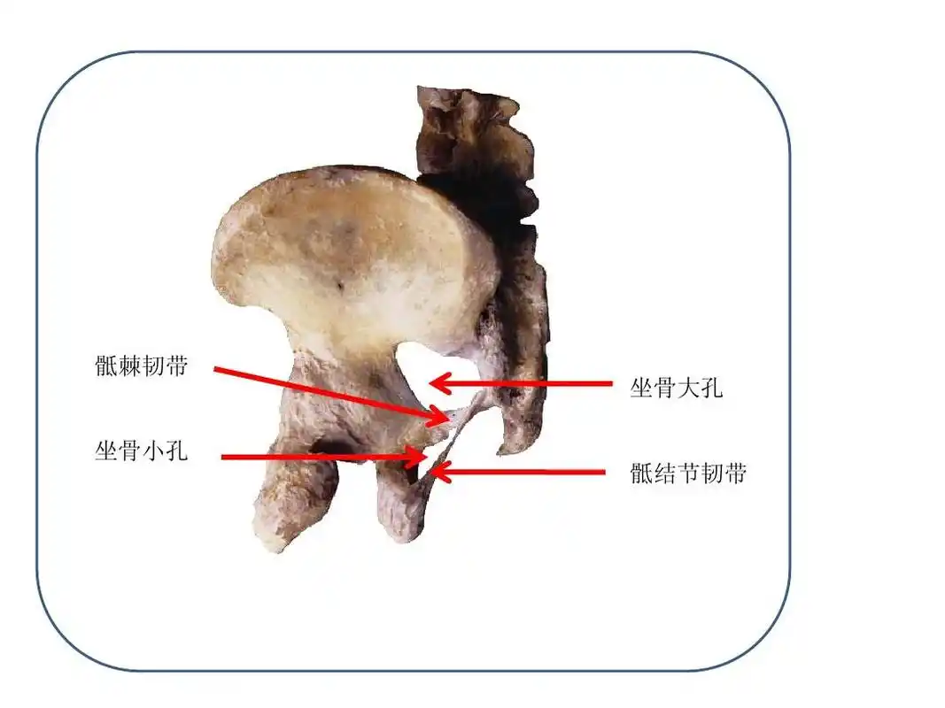 骶棘韧带 骶棘韧带 坐骨大孔 坐骨小孔 骶结节韧带