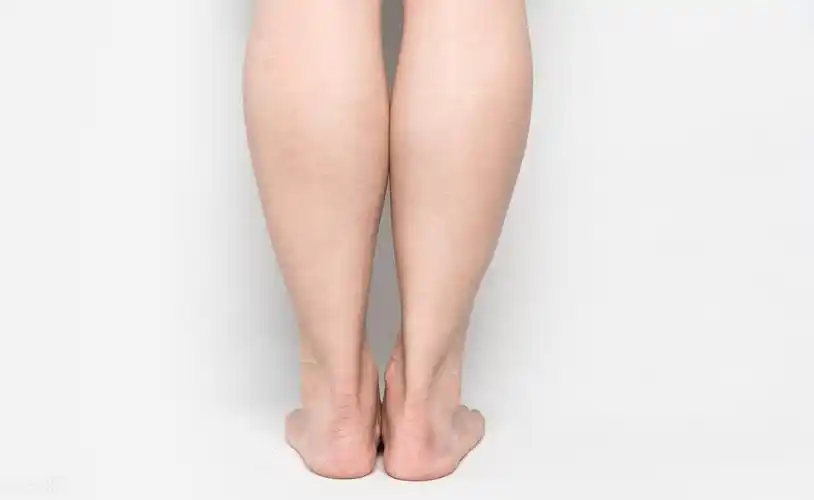 马甲线都练出来,大腿小腿还是那么粗,为什么?