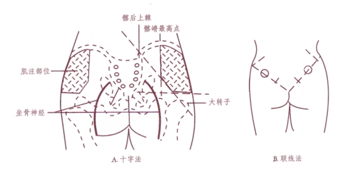 技能操作01肌肉注射
