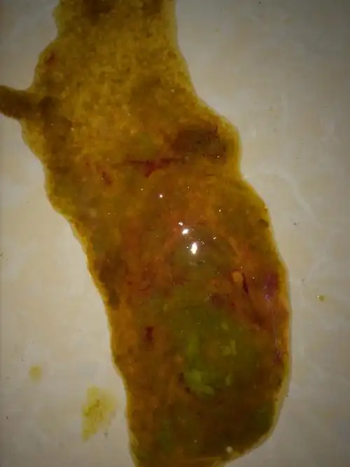 带图慎入 宝宝大便带血 在线求助啊