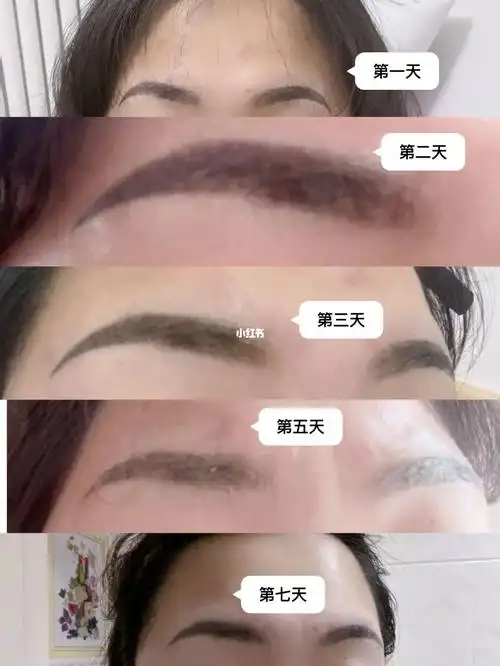 纹眉之后的七天记录