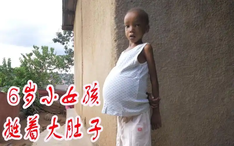 这个小女孩只有6岁却挺着一个大肚子有人说她怀孕了她是怎么怀孕的