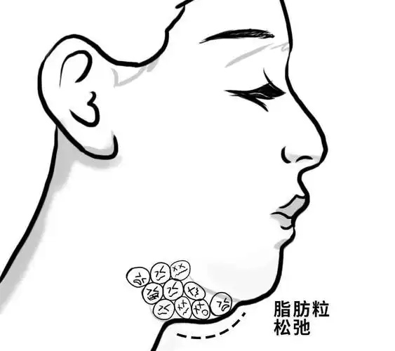 你的双下巴很有可能是你自己造成的!_脂肪