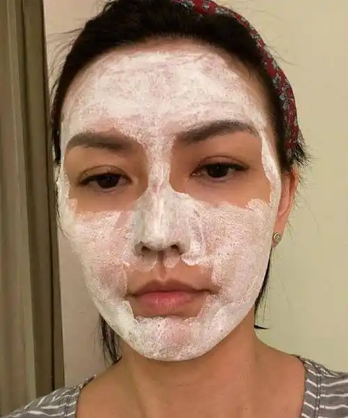 孙燕姿晒怼脸自拍照 自曝压力大疯狂长痘