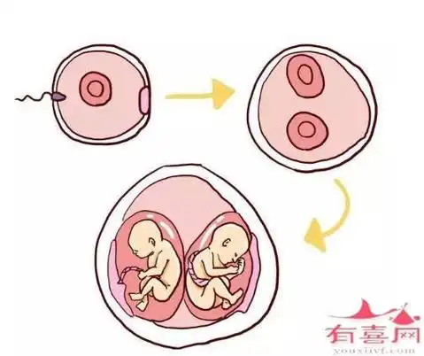 同卵双胞胎-同卵双胞胎形成原因-有喜网