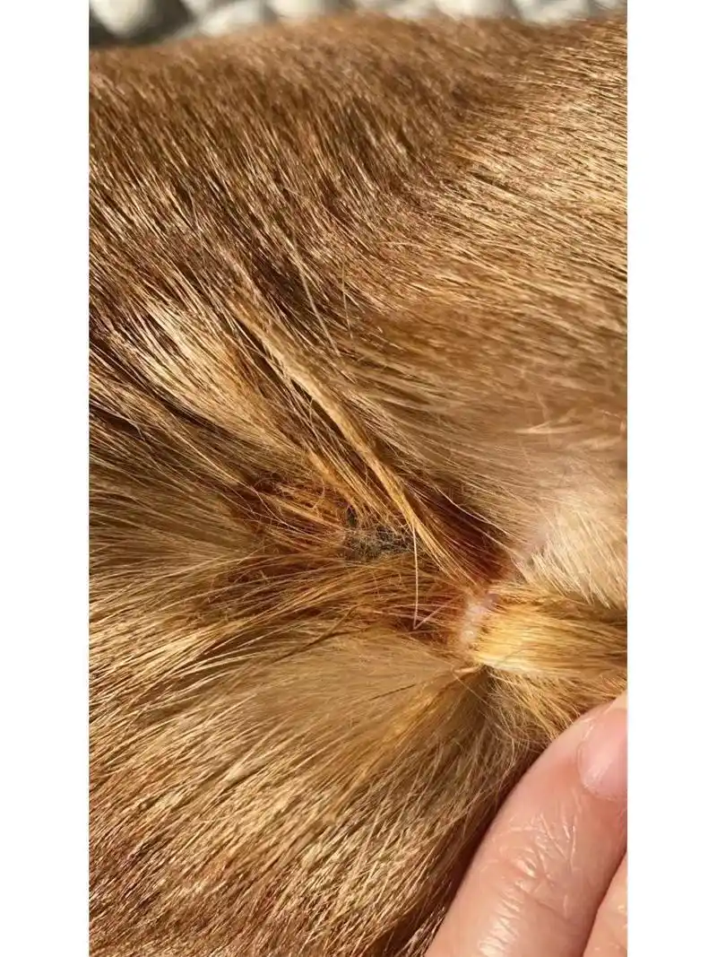 一定要进来看看 97这种情况是非常常见的一种皮肤病——真菌皮肤病