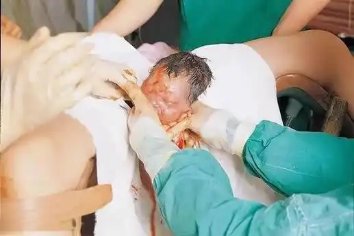 >>产妇生孩子无掩盖图片大全几张图带你看顺产的全过程产妇在医院自然