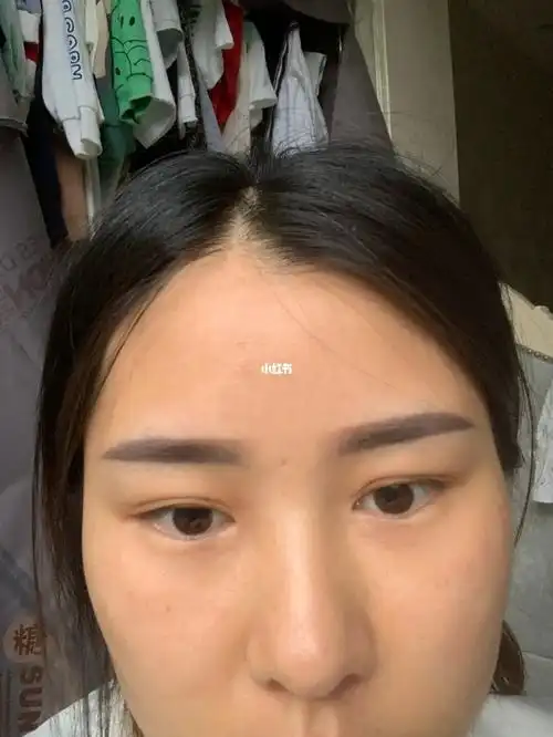 纹眉第一天第八天全部掉掉痂是不是失败了