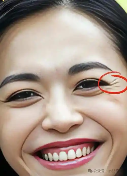 眼尾炸花是指眼尾部位出现明显的纹路,通常是由于频繁笑或年龄增长