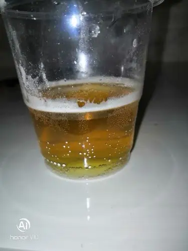 关于小苏打测男女,有图嫌弃者勿进