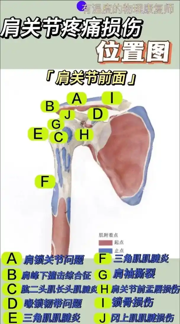 肩关节疼痛位置图,找你的痛点.20个疼痛点.找出你的问题所在 - 抖音