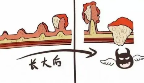 类似肛裂了西宁东大医院看的好这个肛门皲裂吗怎么样