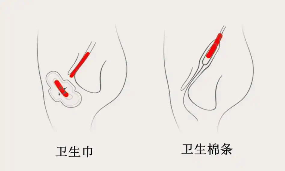 为啥我国女性喜欢卫生巾,外国女人却偏爱卫生棉条?看完就清楚了