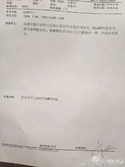 早产儿脑改变是什么意思