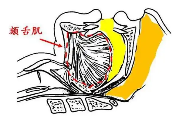 红色标记颏舌肌,睡眠仰卧时舌根后坠堵塞气道.