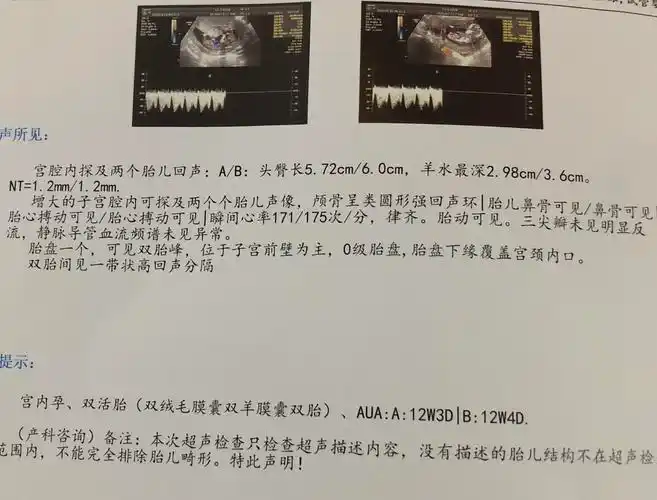 nt顺利通过已知男宝