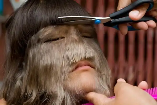 胆小者慎入世界上真实存在的变异人组图