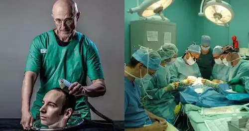 世界首例换头手术实验在中国成功意大利专家有新进展