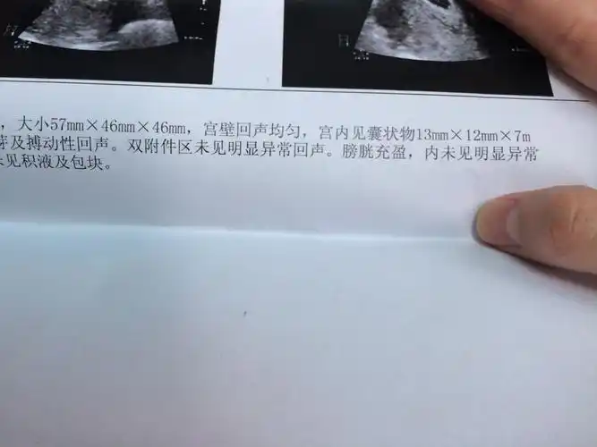 怀孕40天b超13mm12mm7mm是男孩还是女孩