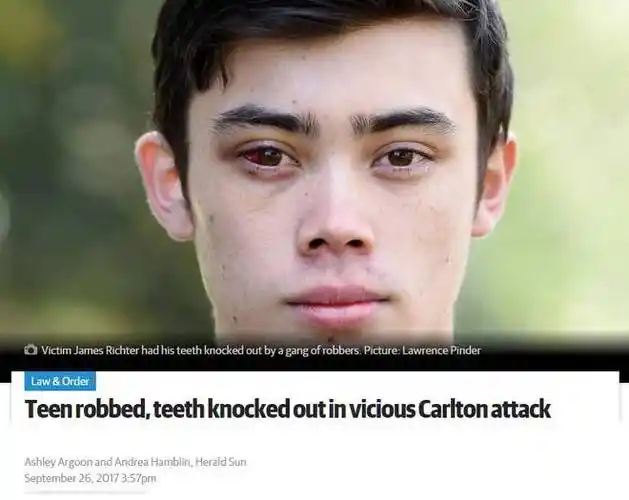 太可怕又是非洲帮墨尔本大学生回家路上遭抢牙齿被打断财物被洗劫