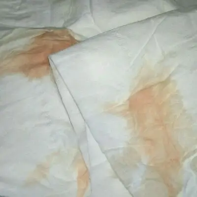 刚怀孕,上厕所发现会有血这是什麼情况