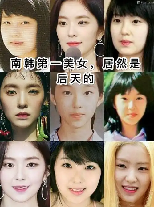 一个妈生脸的整容模版92韩国网友票选出最美女_圈子-新氧美容整形