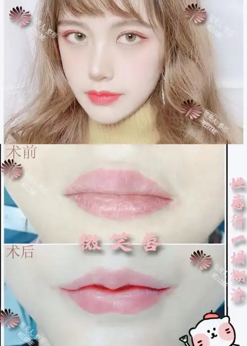 整形〗90 95微笑唇前后对比99 98性格得一塌糊涂94