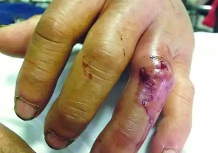 为何人被蜈蚣咬了后会中毒,公鸡吃了却没事?教你被咬后如何自救