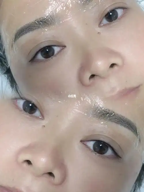 美瞳线单边对比