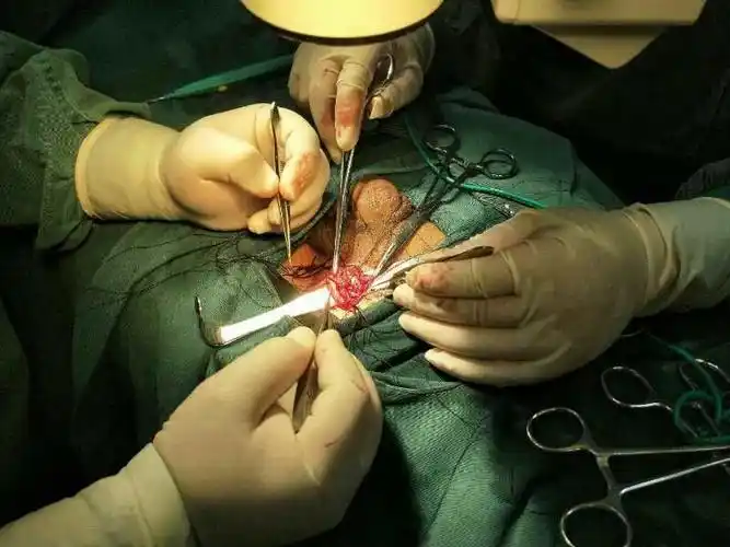 定西市中医院外科手术笔记 ——显微镜下精索静脉结扎术