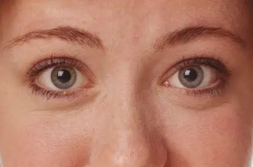 睁大眼睛的女人