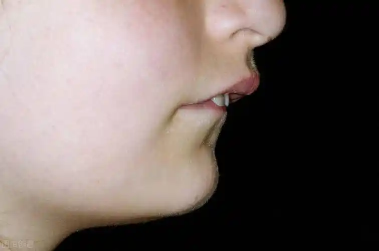 我是如何纠正孩子的牙齿外突问题的_嘴巴_嘴唇_门牙