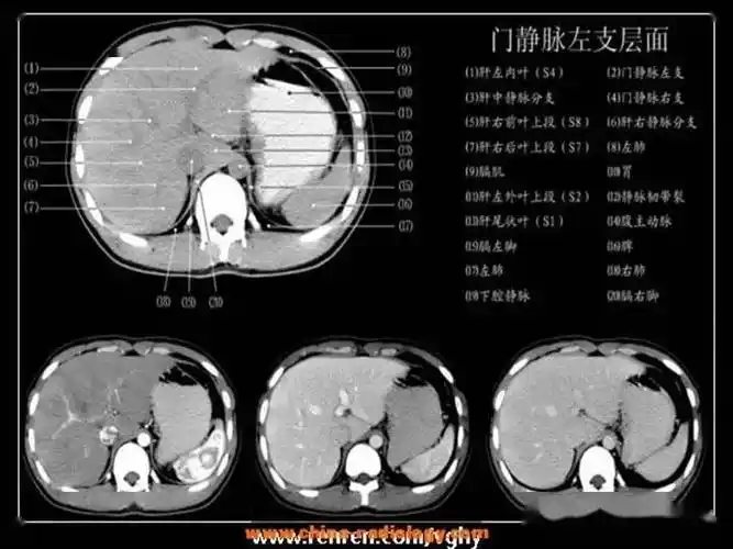 读懂腹部ct解剖只花1小时