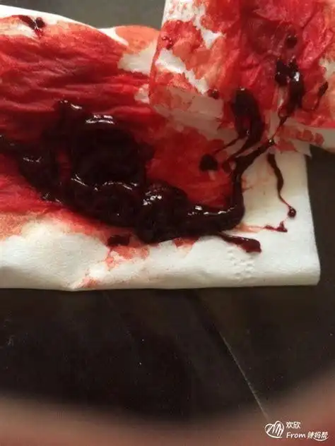 月经突然量大有血块月经突然量大有血块是怎么回事2022已更新今日资讯