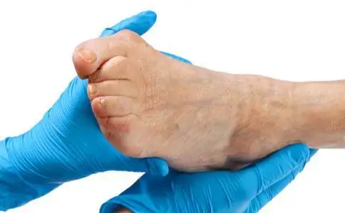 老人脚肿什么原因 3招能消肿