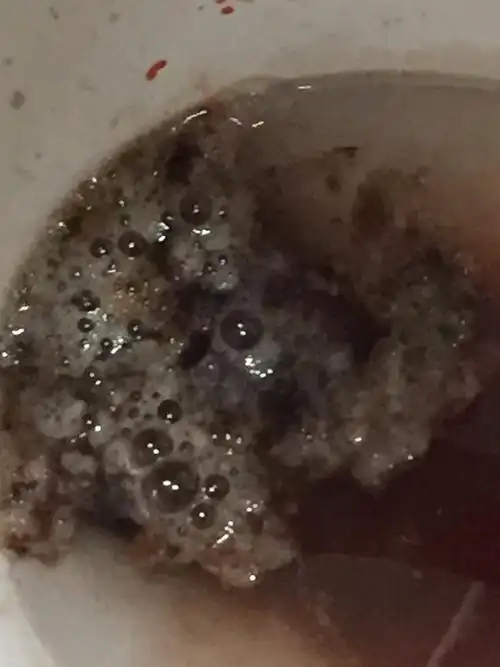 孕妇15周,今天吃的面条和少量的油饼,平时也有呕吐反应,但今天晚上