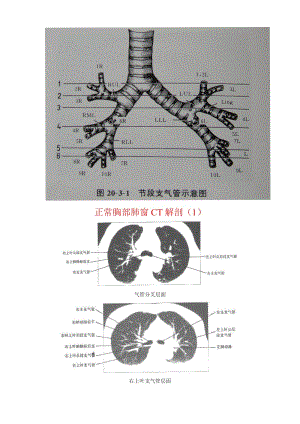 正常胸部ct肺窗和纵隔窗