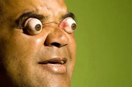 匪夷所思的人体器官潜能盘点 眼皮拉汽车【3】