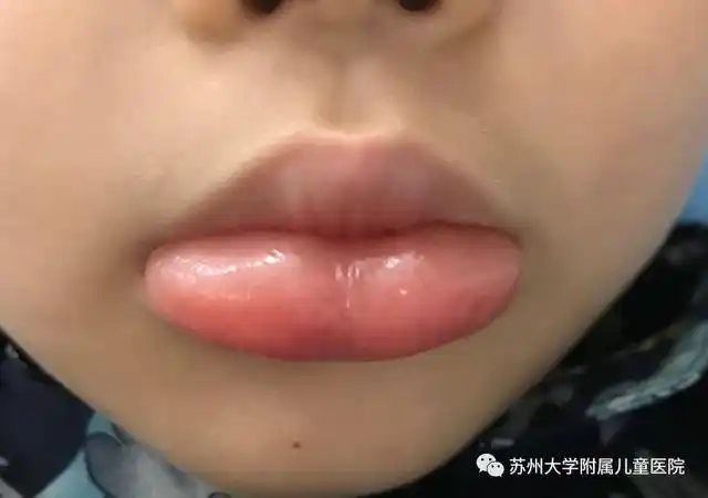 吃了抖音超火的冰淇淋,苏州一儿童进了医院!很多家长还不知道这么危险