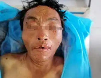 认尸启事昨天在砚山夜色ktv岔路路段交通事故死亡一人