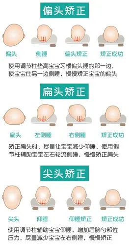 婴儿枕头防偏头婴儿定型枕纠正偏头新生儿头型矫正宝宝枕头0-1岁_券