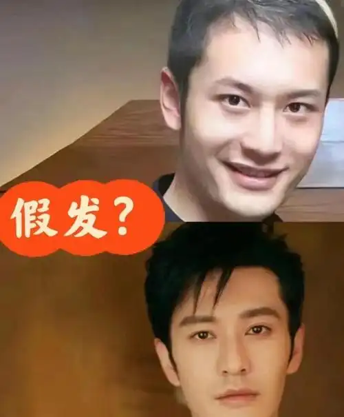 明星戴的假发片你不会没看出来吧别再秃头焦虑了