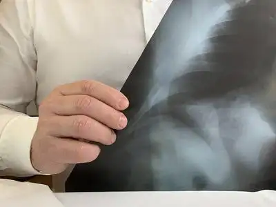 一个穿白衬衫的医生在看x光片.一个男人手里拿着x光胸片.