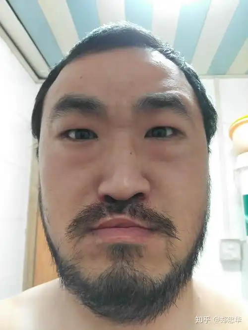 长得丑是一种什么样的体验